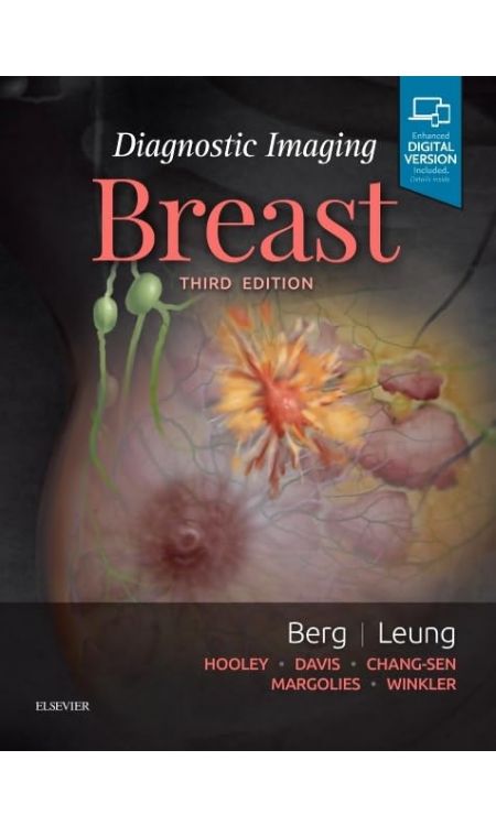Diagnostic Imaging: Breast 3th Edition