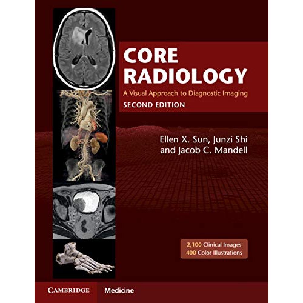 Core Radiology "A Visual Approach to Diagnostic Imaging" 2nd edition