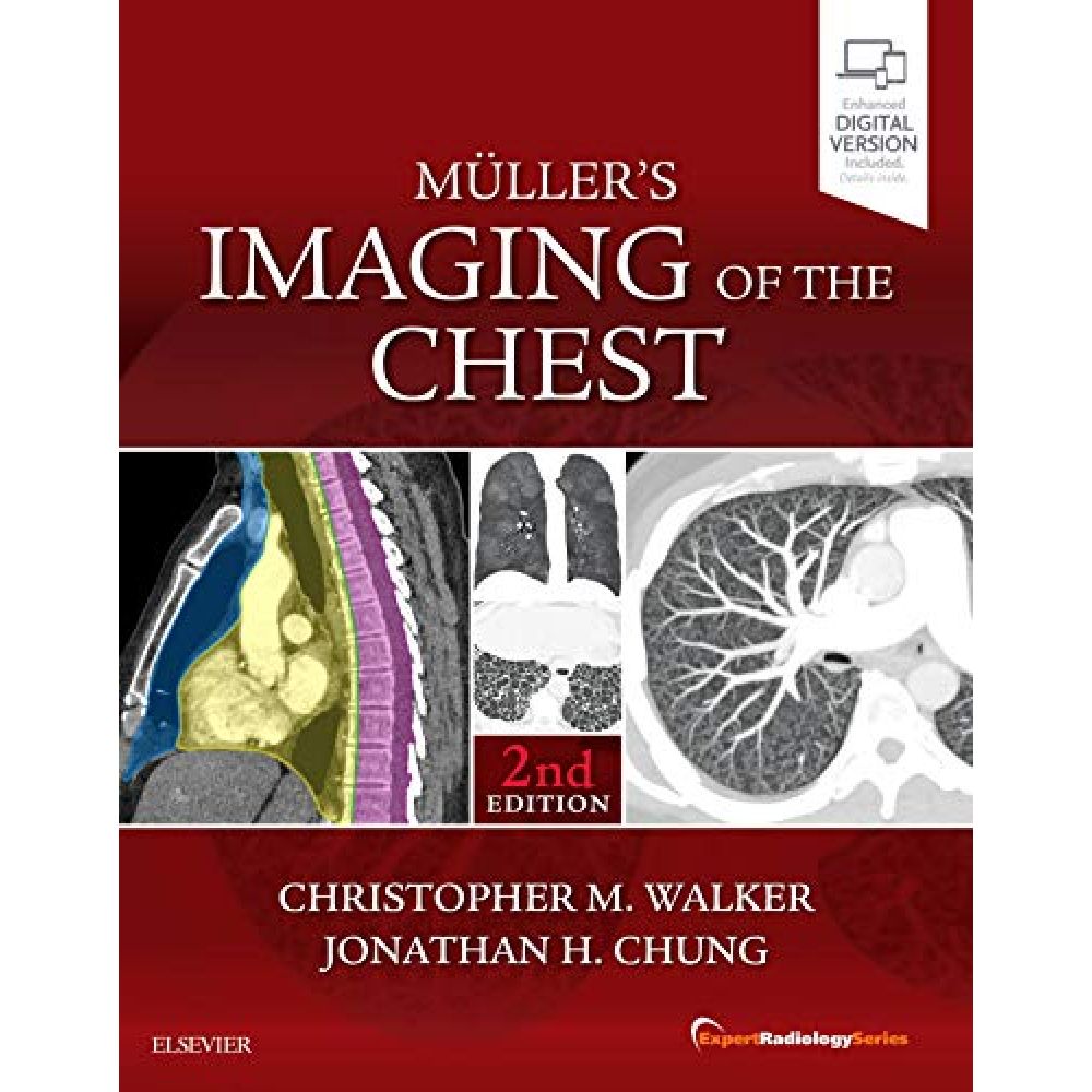 Muller's Imaging of the Chest: Expert Radiology Series  2nd Edition