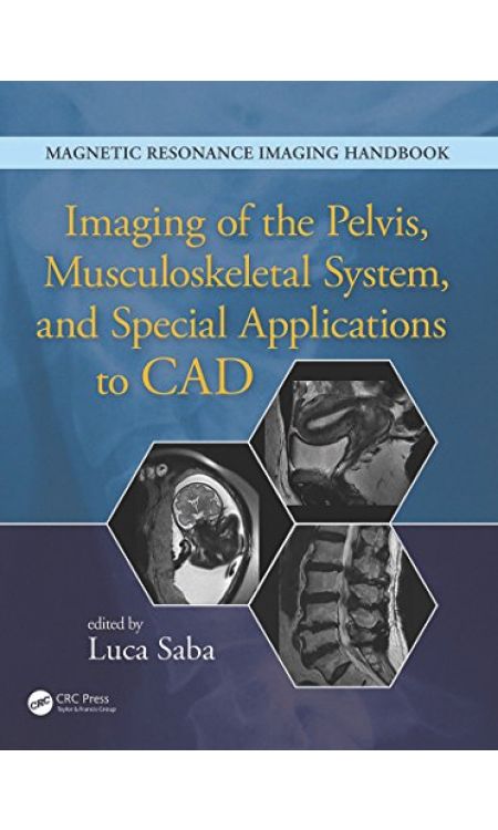 Imaging of the Pelvis, Musculoskeletal System, and Special Applications to CAD (Magnetic Resonance Imaging Handbook)  1st Edition