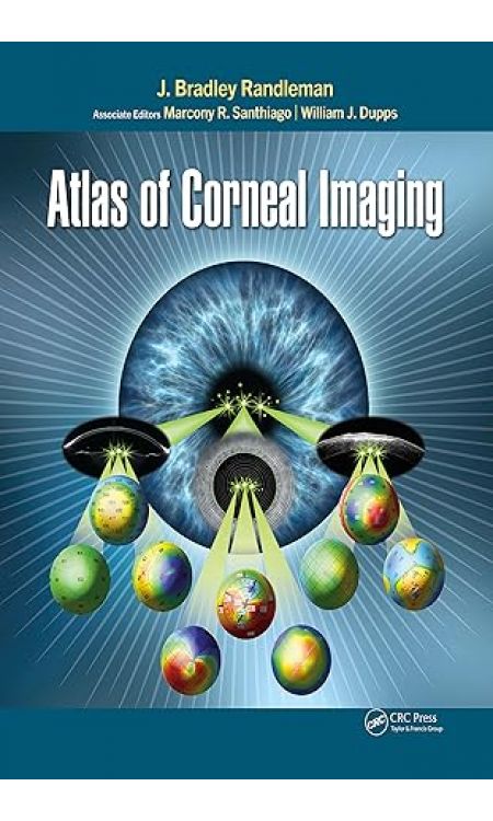Atlas of Corneal Imaging Kindle Edition