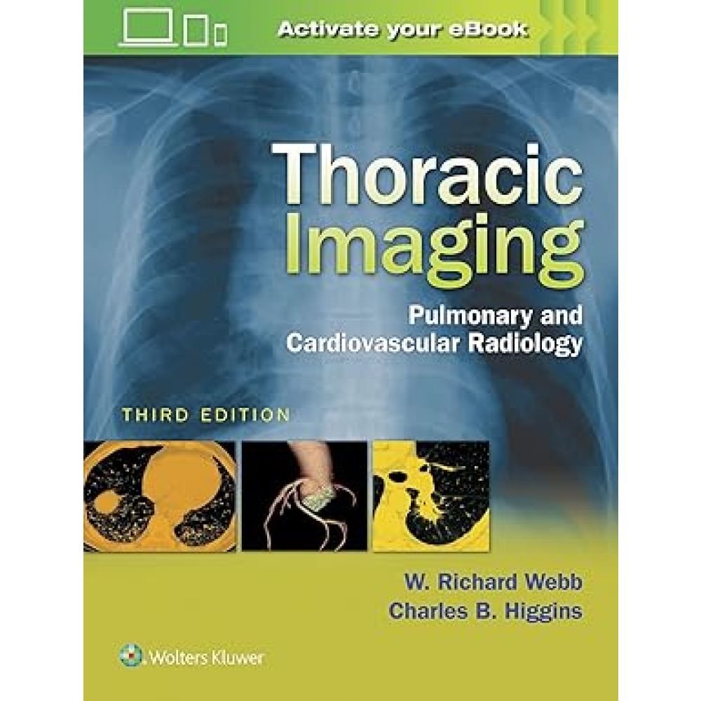 Thoracic Imaging: Pulmonary and Cardiovascular Radiology Third Edition