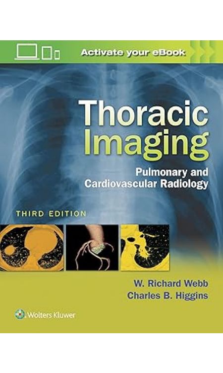 Thoracic Imaging: Pulmonary and Cardiovascular Radiology Third Edition