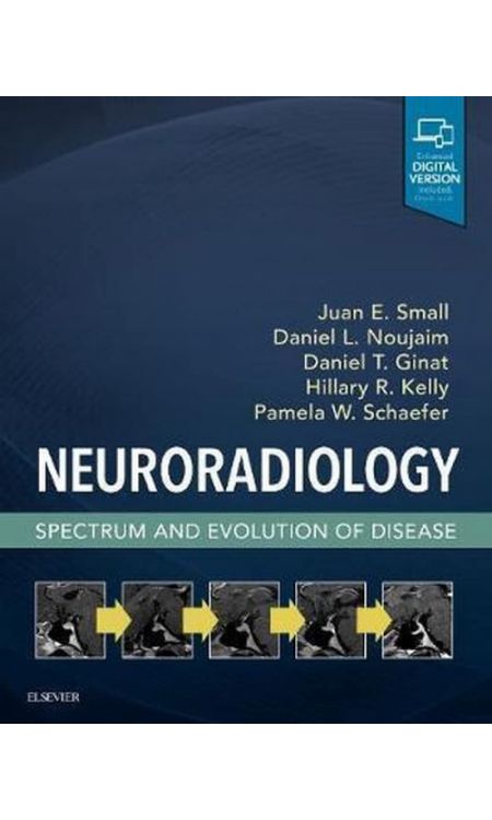 Neuroradiology: Spectrum and Evolution of Disease