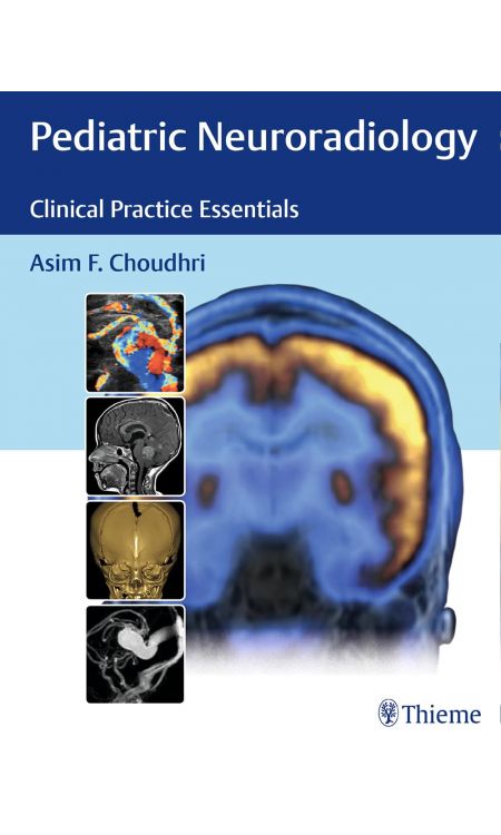Pediatric Neuroradiology: Clinical Practice Essentials