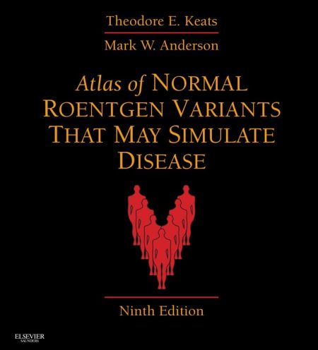 Atlas of Normal Roentgen Variants That May Simulate Disease E-Book  9th Edition