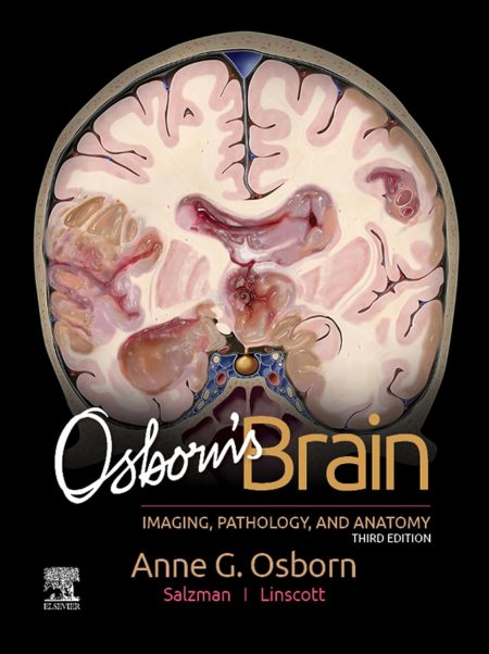 Osborn's Brain E-Book 3rd Edition