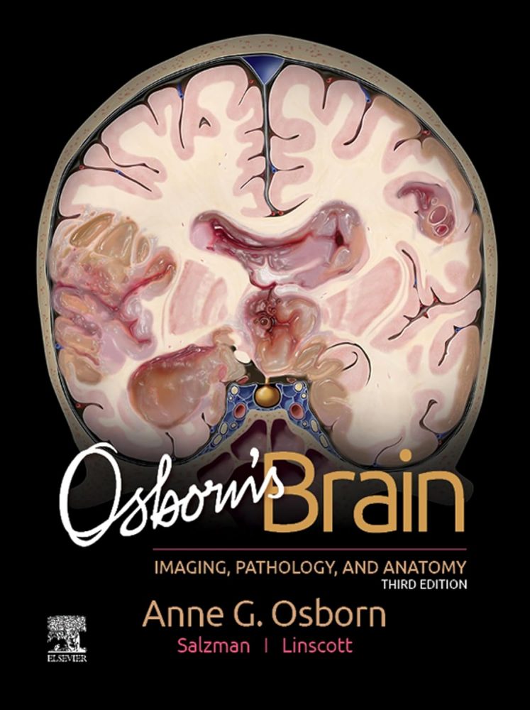 Osborn's Brain E-Book 3rd Edition