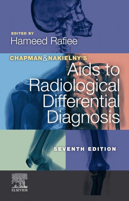 Chapman & Nakielny's Aids to Radiological Differential Diagnosis 7th Edition