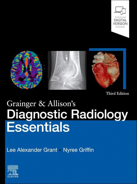 Grainger & Allison's Diagnostic Radiology Essentials E-Book  3rd Edition