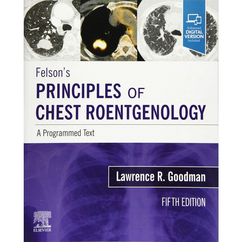 Felson's Principles of Chest Roentgenology, A Programmed Text: A Programmed Text 5th Edition
