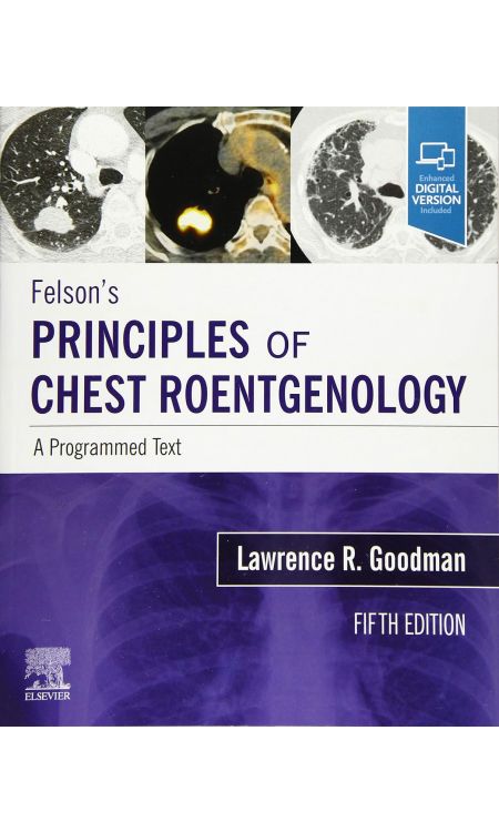 Felson's Principles of Chest Roentgenology, A Programmed Text: A Programmed Text 5th Edition