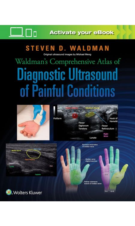 Waldman’s Comprehensive Atlas of Diagnostic Ultrasound of Painful Conditions