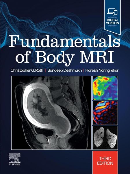 Fundamentals of Body MRI E-Book (Fundamentals of Radiology)  3rd Edition