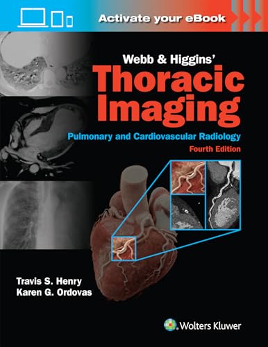 Webb & Higgins Thoracic Imaging: Print + eBook with Multimedia  Fourth Edition