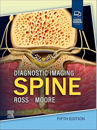 Diagnostic Imaging: Spine 5th Edition