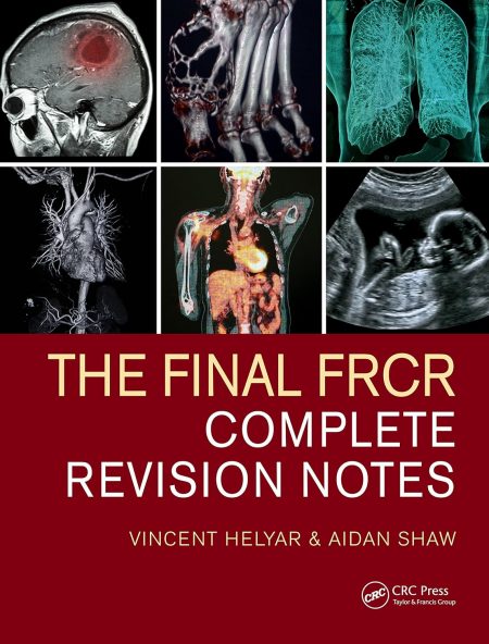 The Final FRCR: Complete Revision Notes 1st Edition