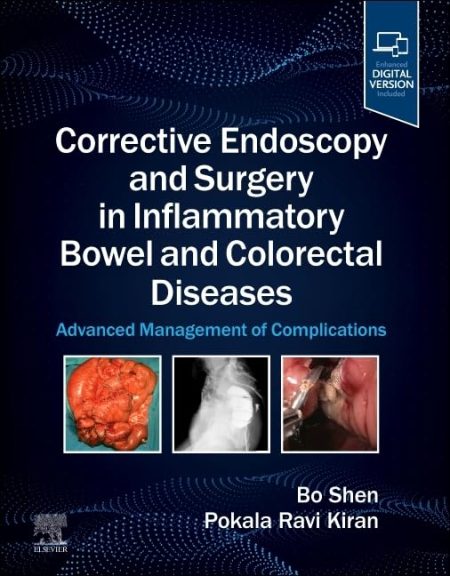 Corrective Endoscopy and Surgery in Inflammatory Bowel and Colorectal Diseases: Advanced Management of Complications (True PDF)