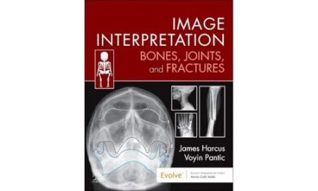 Image Interpretation: Bones, Joints, and Fractures  1st Edition