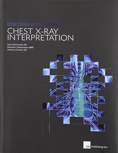 Discover Radiology: Chest X-Ray Interpretation